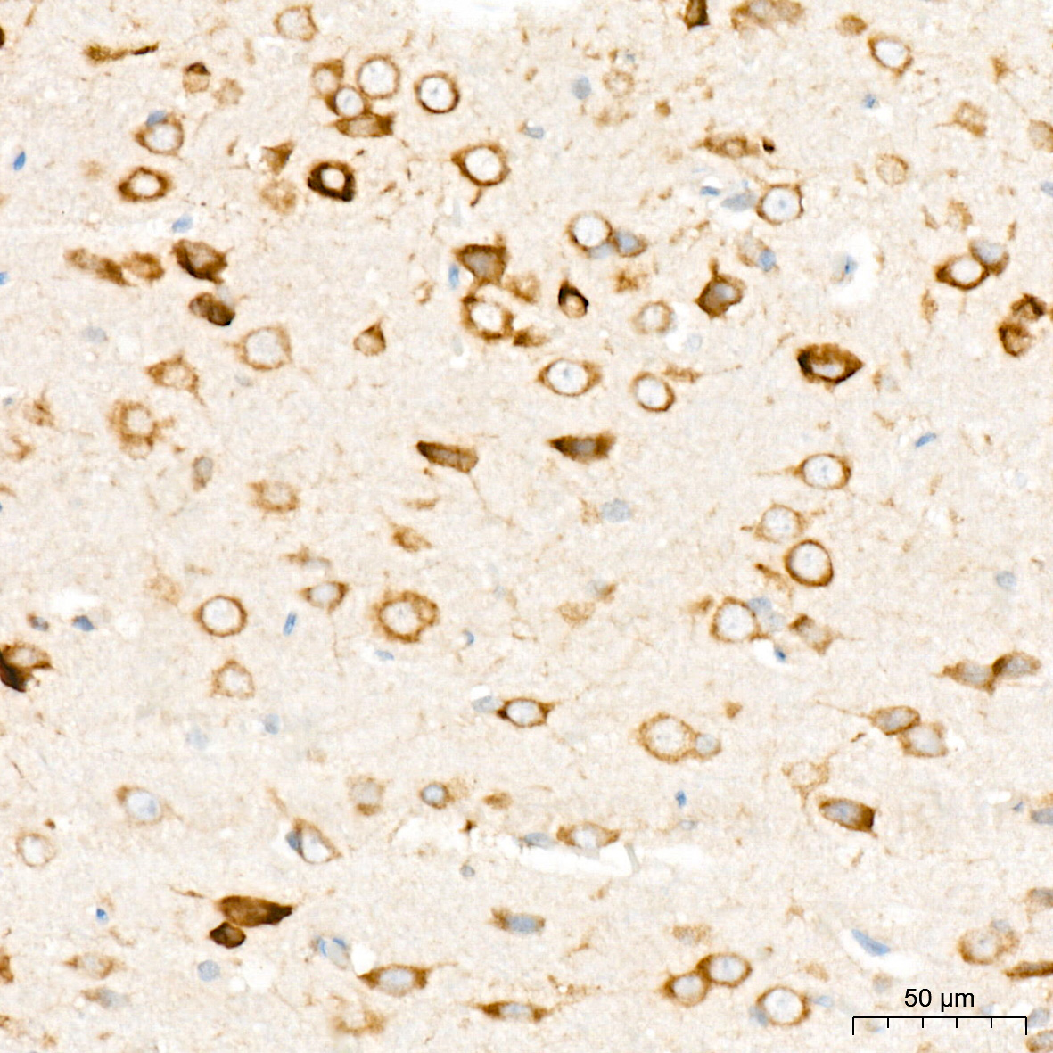 PRKRA/PACT Rabbit Monoclonal Antibody - Image 2
