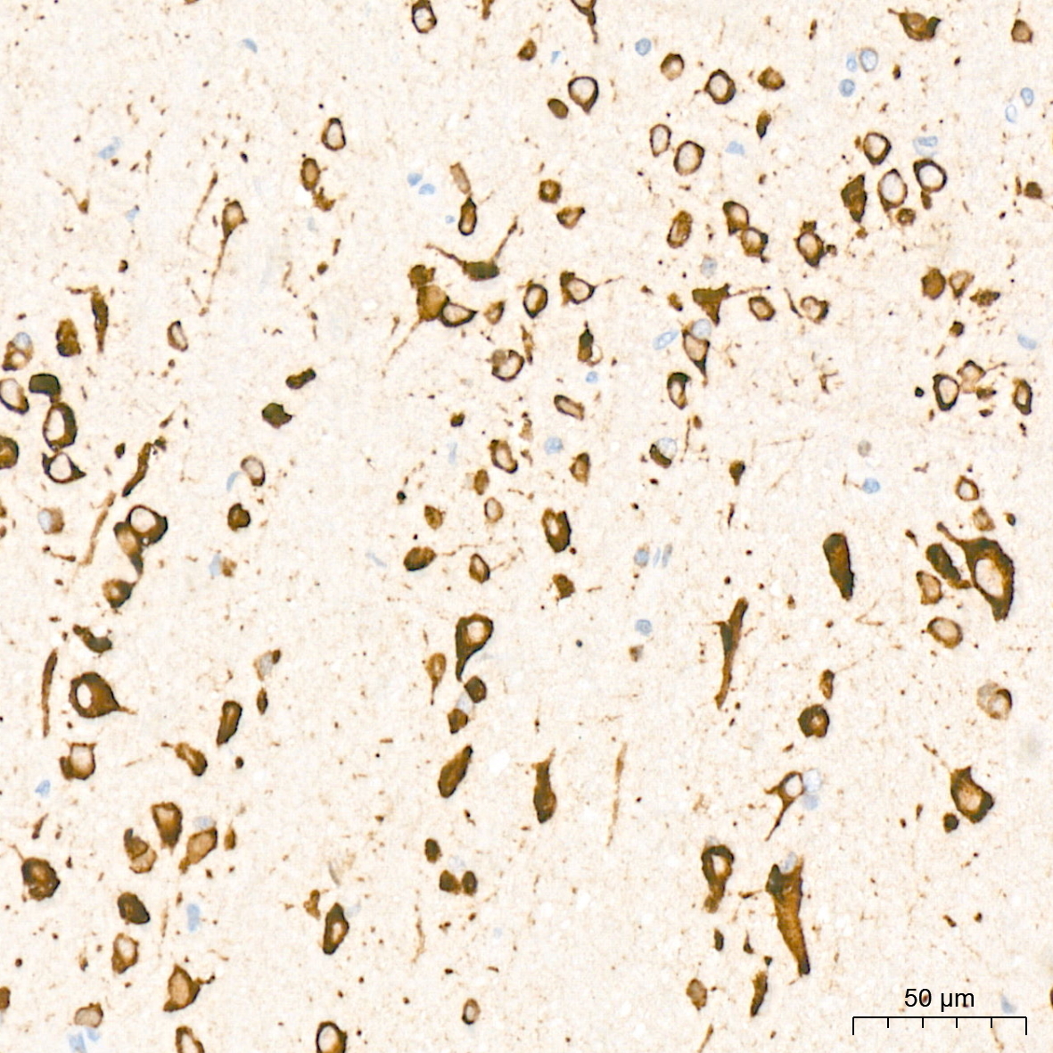 PRKRA/PACT Rabbit Monoclonal Antibody - Image 3