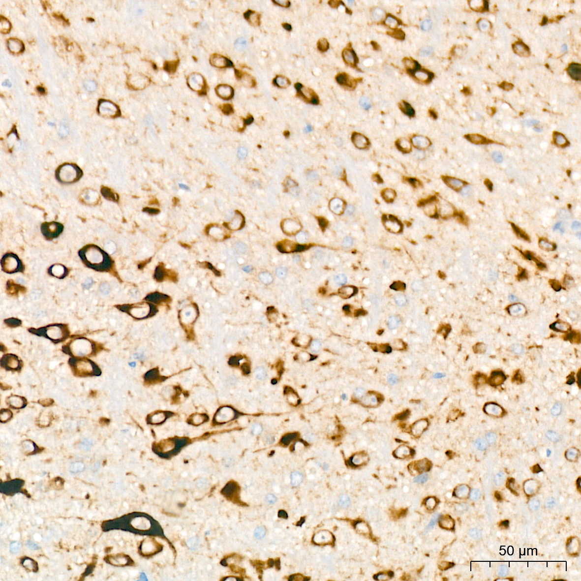 PRKRA/PACT Rabbit Monoclonal Antibody - Image 4