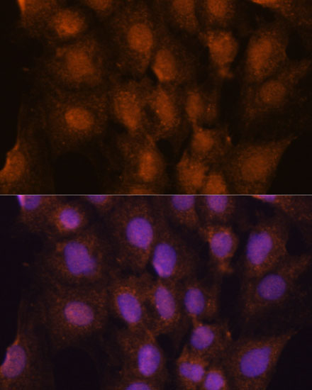 PRKRIP1 Rabbit Polyclonal Antibody - Image 2
