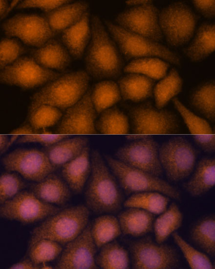 PRKRIP1 Rabbit Polyclonal Antibody - Image 3