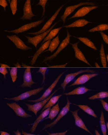 PRKRIP1 Rabbit Polyclonal Antibody - Image 4