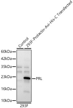 PRL Rabbit Polyclonal Antibody