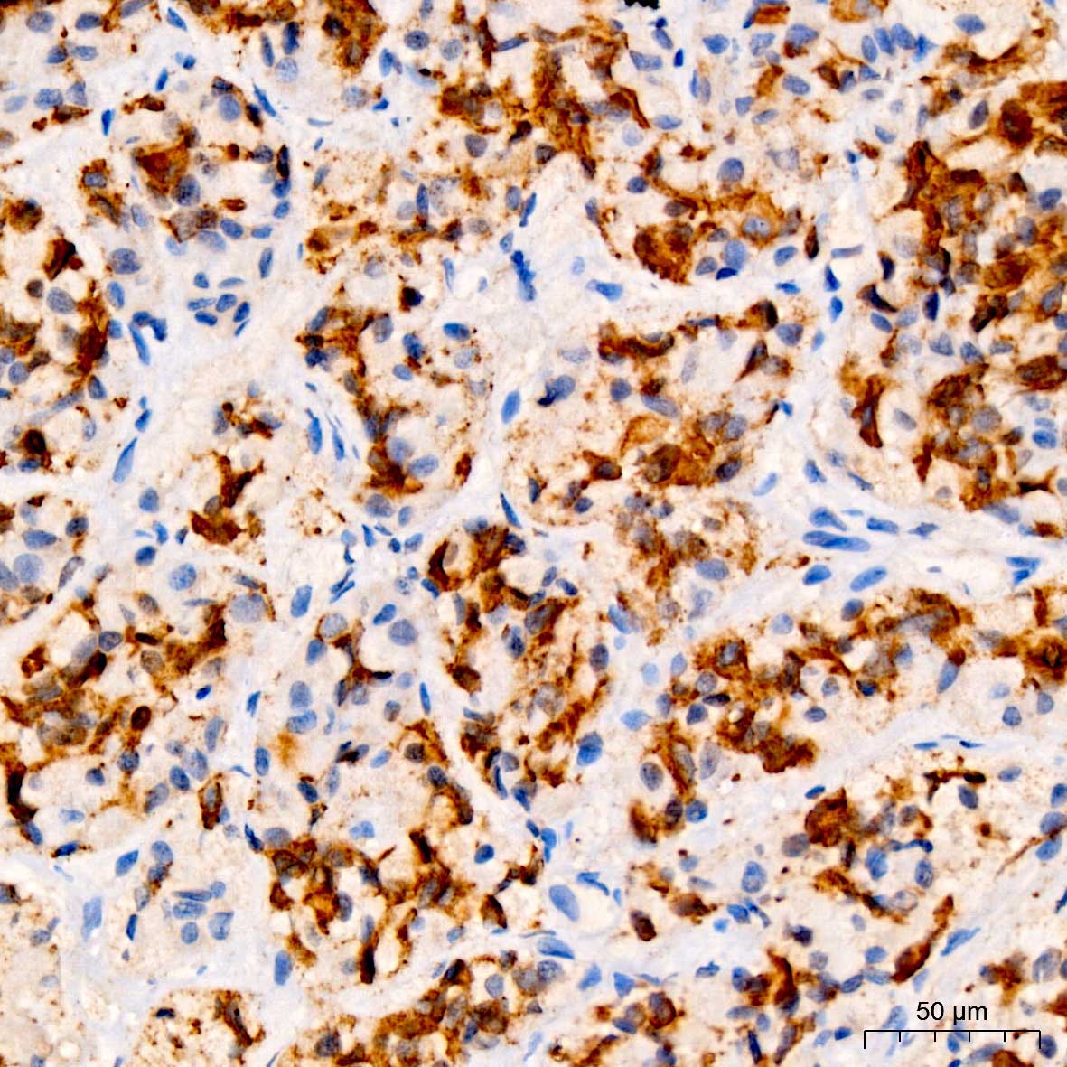 PRL Rabbit Polyclonal Antibody - Image 2