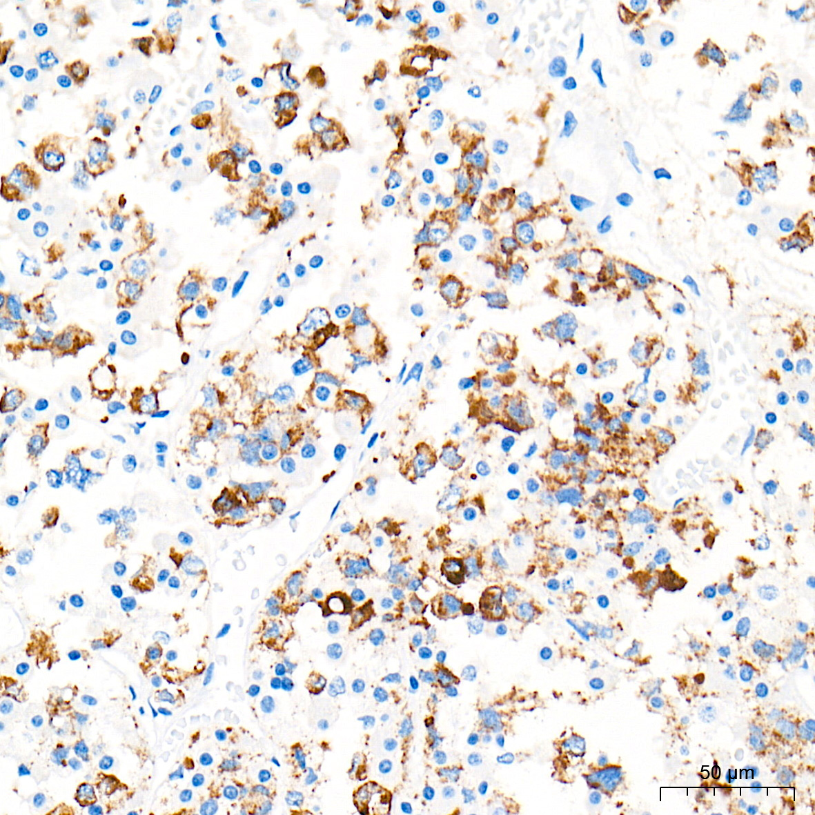 PRL/Prolactin Rabbit Monoclonal Antibody