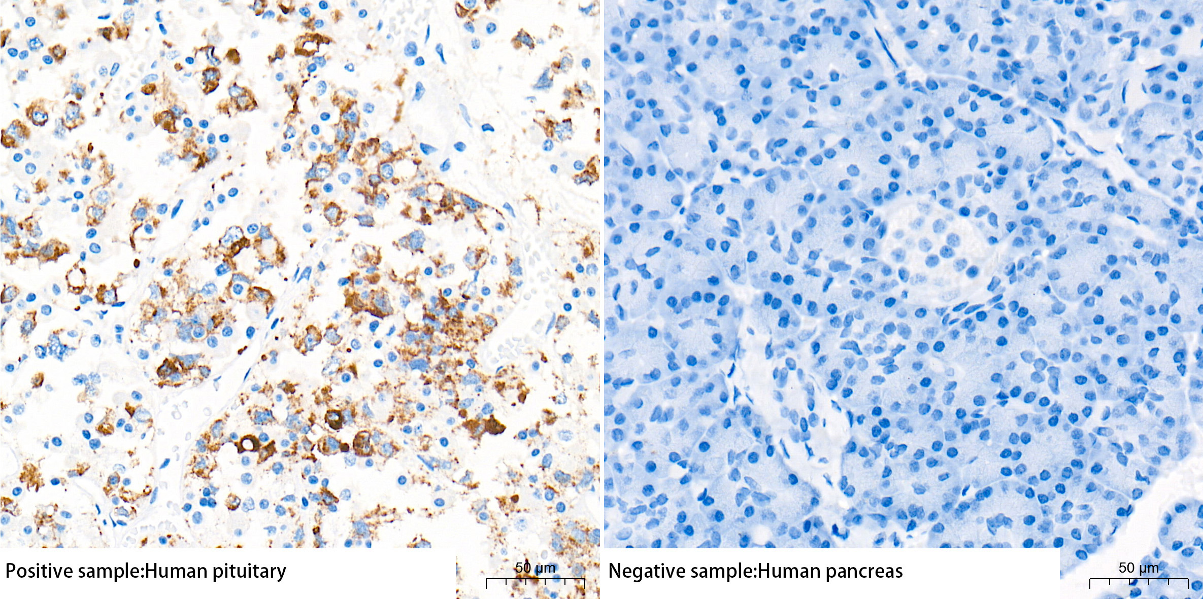 PRL/Prolactin Rabbit Monoclonal Antibody - Image 2