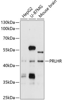 PRLHR Rabbit Polyclonal Antibody