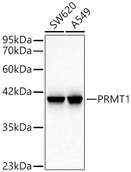 PRMT1 Rabbit Monoclonal Antibody