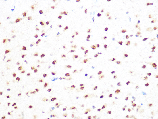 PRMT1 Rabbit Monoclonal Antibody - Image 2