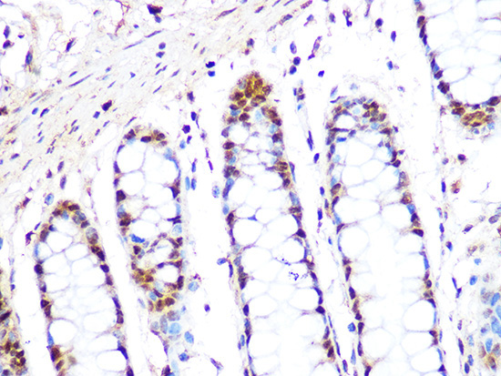 PRMT1 Rabbit Monoclonal Antibody - Image 3