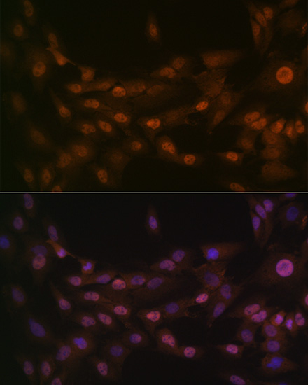 PRMT1 Rabbit Monoclonal Antibody - Image 4
