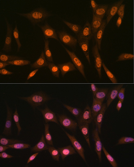 PRMT1 Rabbit Monoclonal Antibody - Image 5