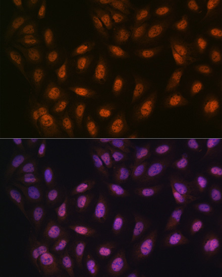 PRMT1 Rabbit Monoclonal Antibody - Image 6