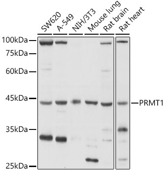 PRMT1 Rabbit Polyclonal Antibody