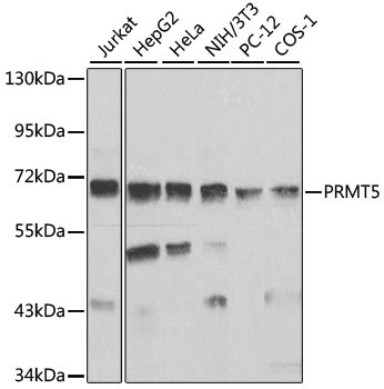 PRMT5 Rabbit Polyclonal Antibody