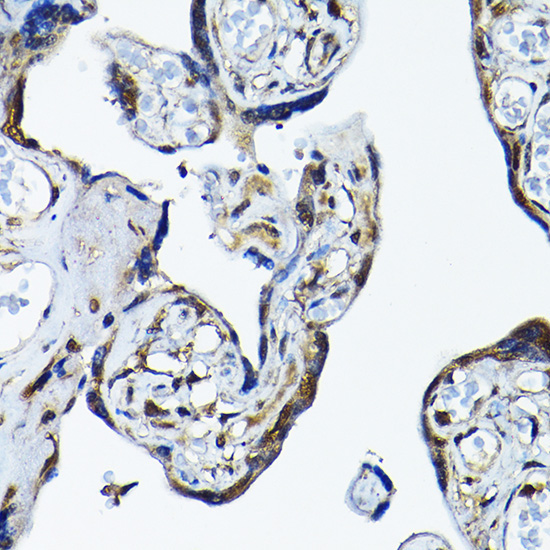 PRMT5 Rabbit Polyclonal Antibody - Image 2