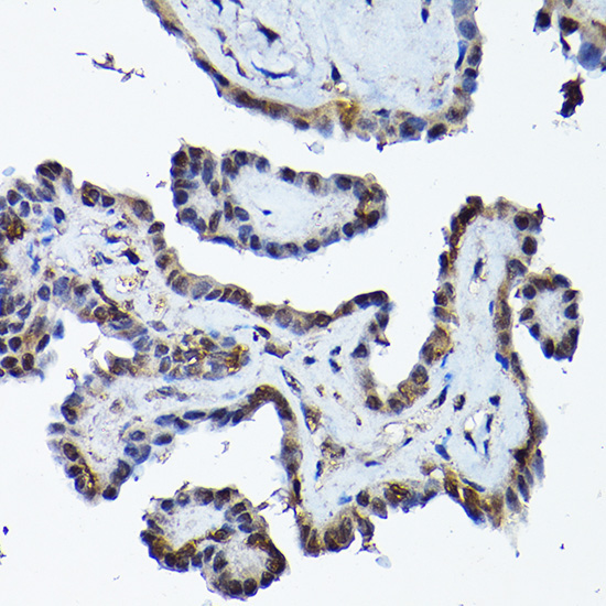 PRMT5 Rabbit Polyclonal Antibody - Image 3