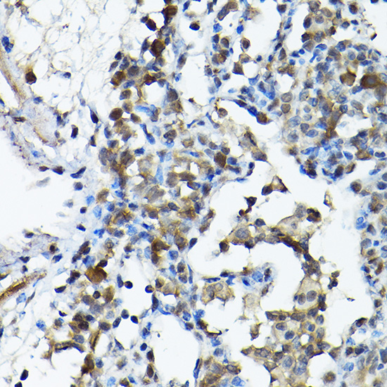 PRMT5 Rabbit Polyclonal Antibody - Image 4