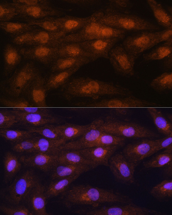 PRMT5 Rabbit Polyclonal Antibody - Image 5