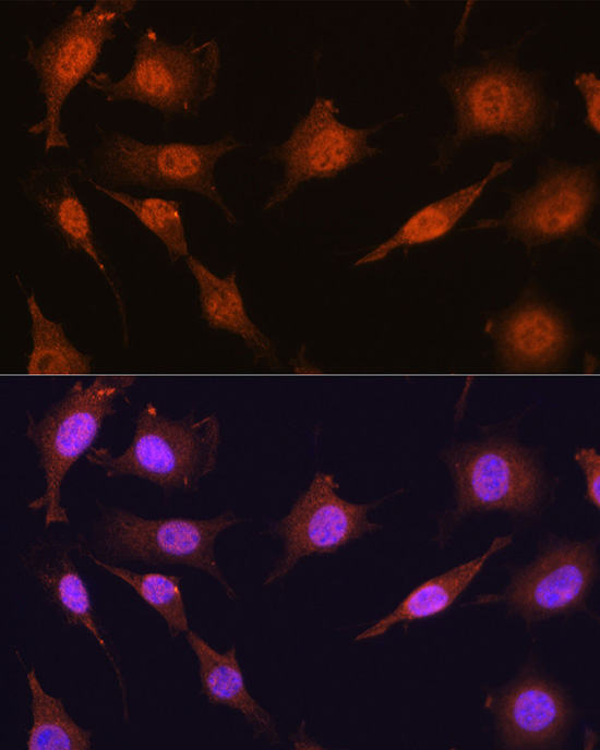 PRMT5 Rabbit Polyclonal Antibody - Image 6