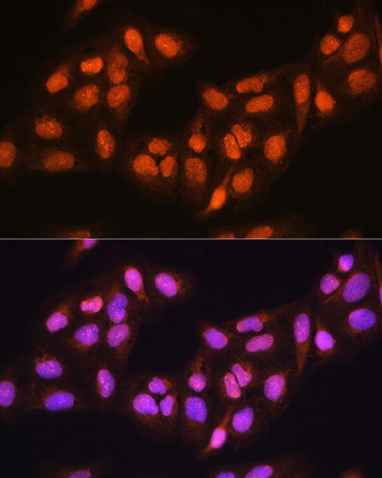 PRMT5 Rabbit Polyclonal Antibody - Image 7