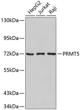 PRMT5 Rabbit Polyclonal Antibody