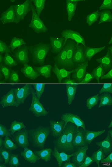 PRMT6 Rabbit Polyclonal Antibody - Image 2