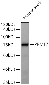 PRMT7 Rabbit Monoclonal Antibody - Image 2