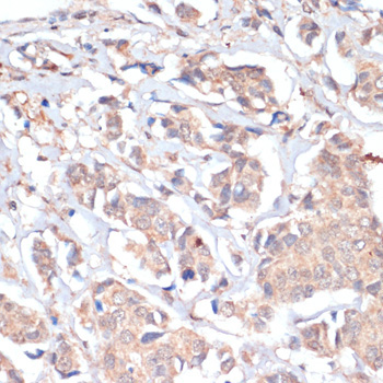 PRMT7 Rabbit Polyclonal Antibody