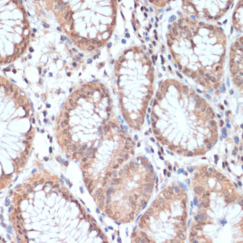 PRMT7 Rabbit Polyclonal Antibody - Image 2