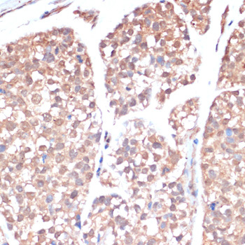 PRMT7 Rabbit Polyclonal Antibody - Image 3
