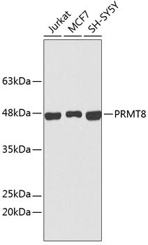 PRMT8 Rabbit Polyclonal Antibody
