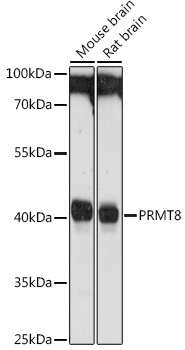 PRMT8 Rabbit Polyclonal Antibody - Image 2