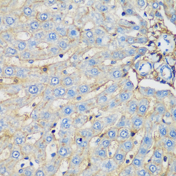 PROCR Rabbit Polyclonal Antibody - Image 2