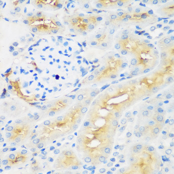 PROCR Rabbit Polyclonal Antibody - Image 3