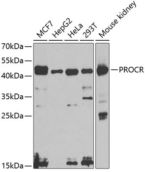 PROCR Rabbit Polyclonal Antibody