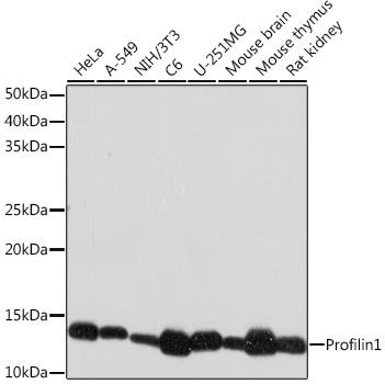 Profilin1 Rabbit Monoclonal Antibody