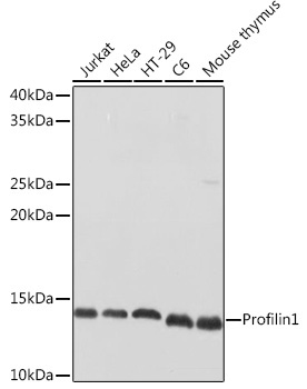 Profilin1 Rabbit Polyclonal Antibody