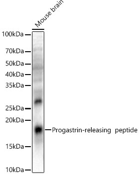 Progastrin-releasing peptide Rabbit Polyclonal Antibody