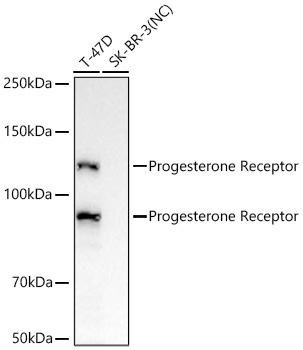 Progesterone Receptor Rabbit Monoclonal Antibody
