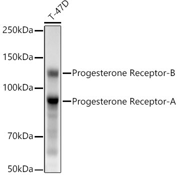 Progesterone Receptor Rabbit Monoclonal Antibody
