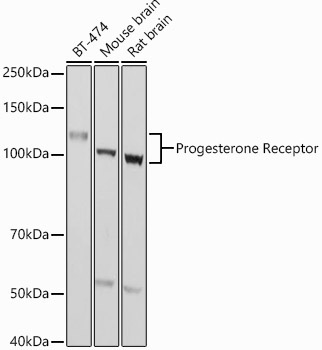 Progesterone Receptor Rabbit Polyclonal Antibody