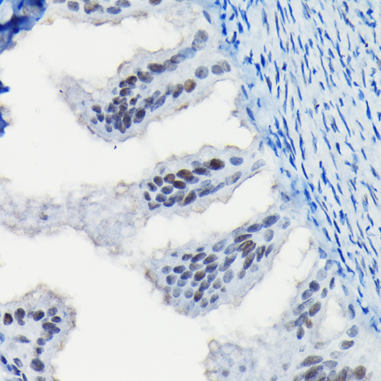Progesterone Receptor Rabbit Polyclonal Antibody - Image 2