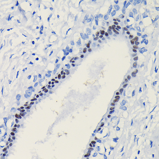 Progesterone Receptor Rabbit Polyclonal Antibody - Image 3