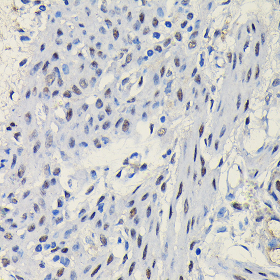 Progesterone Receptor Rabbit Polyclonal Antibody - Image 4
