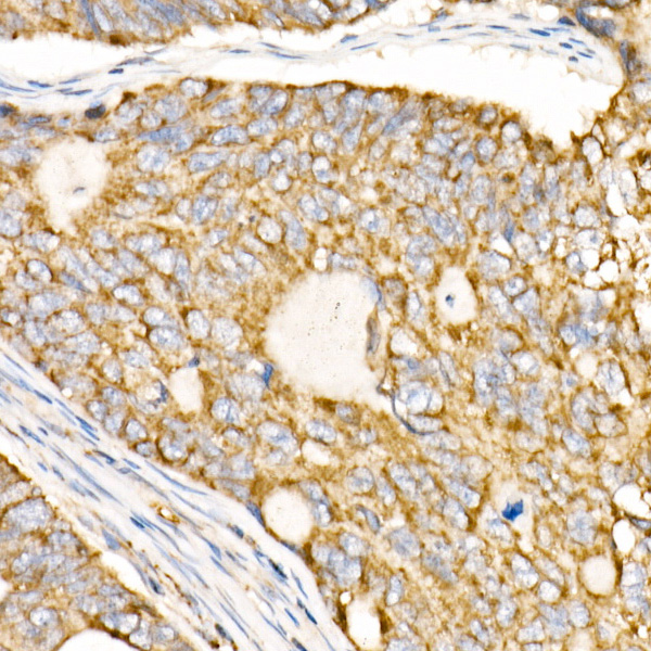 Prohibitin Rabbit Polyclonal Antibody - Image 2