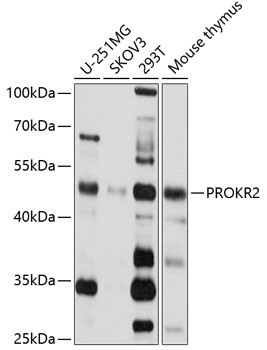 PROKR2 Rabbit Polyclonal Antibody