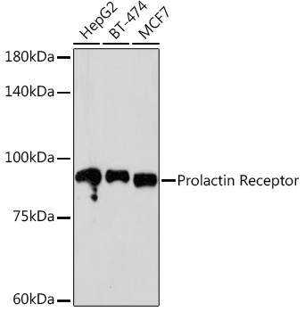 Prolactin Receptor Rabbit Monoclonal Antibody
