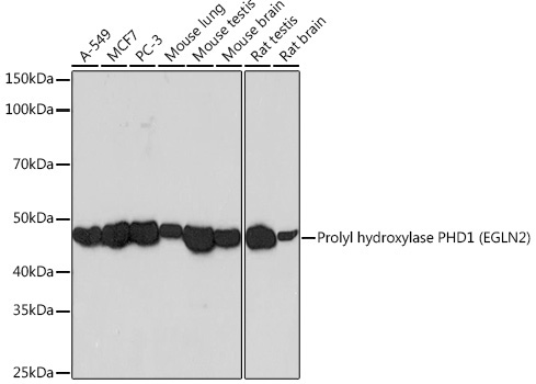Prolyl hydroxylase PHD1 (EGLN2) Rabbit Monoclonal Antibody