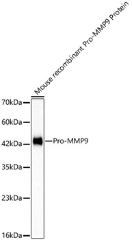 Pro-MMP9 Rabbit Monoclonal Antibody